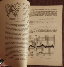 Неотложная помощь при сердечно-сосудистых заболеваниях. 1986 - фото 3